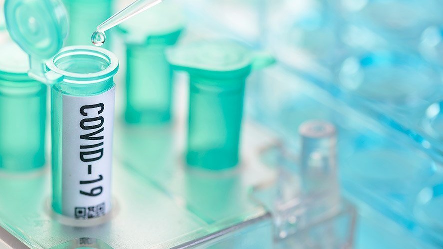 Wiler lancieren PCR-Tests mit Speichelprobe
